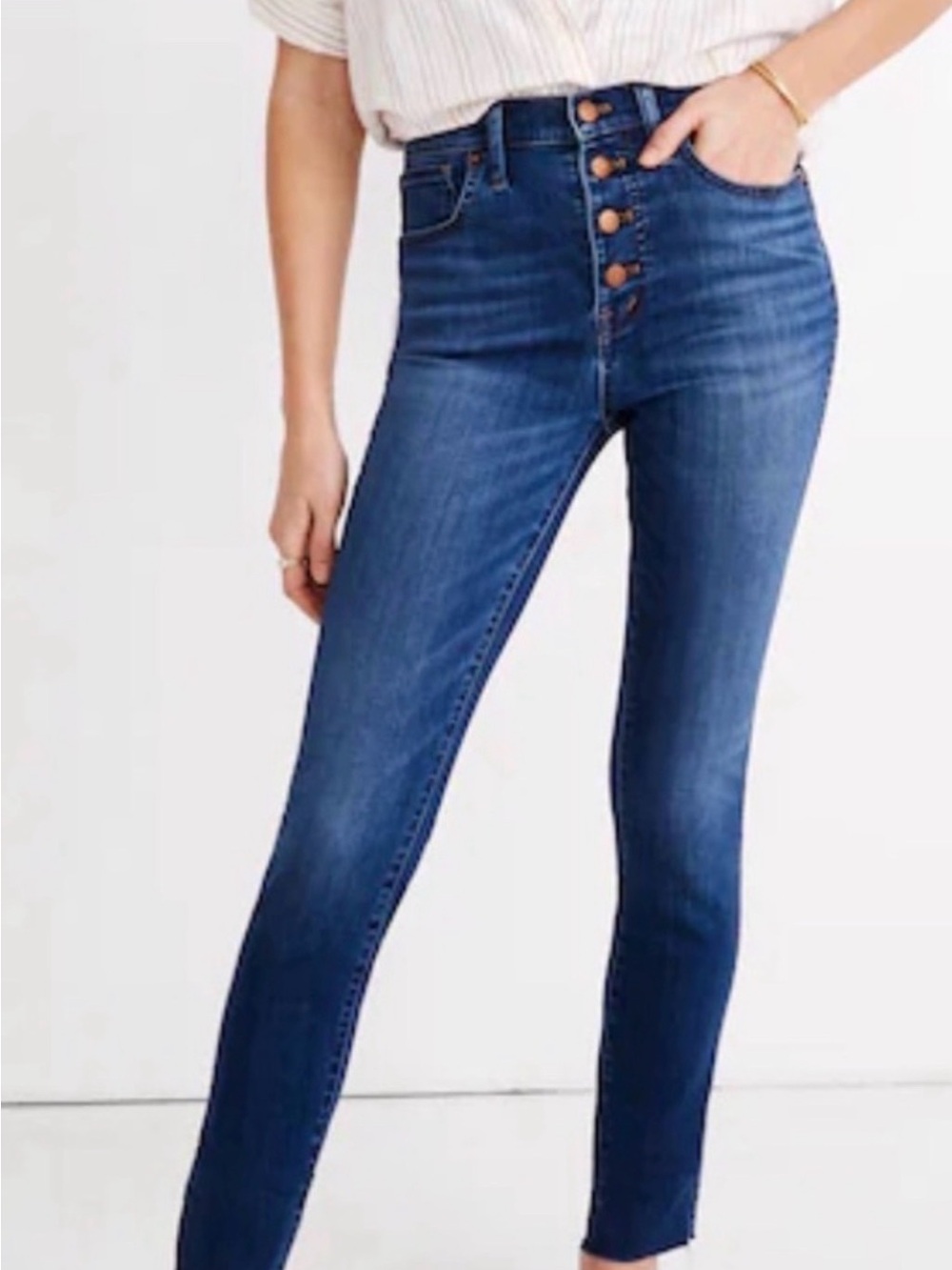Madewell Button-Fly Skinny Jeans